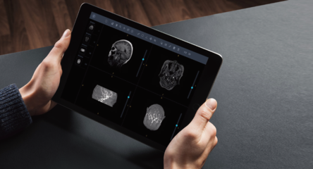 厚積薄發 匯醫慧影CCR2019三大產品線升級，構建智慧影像全域生態